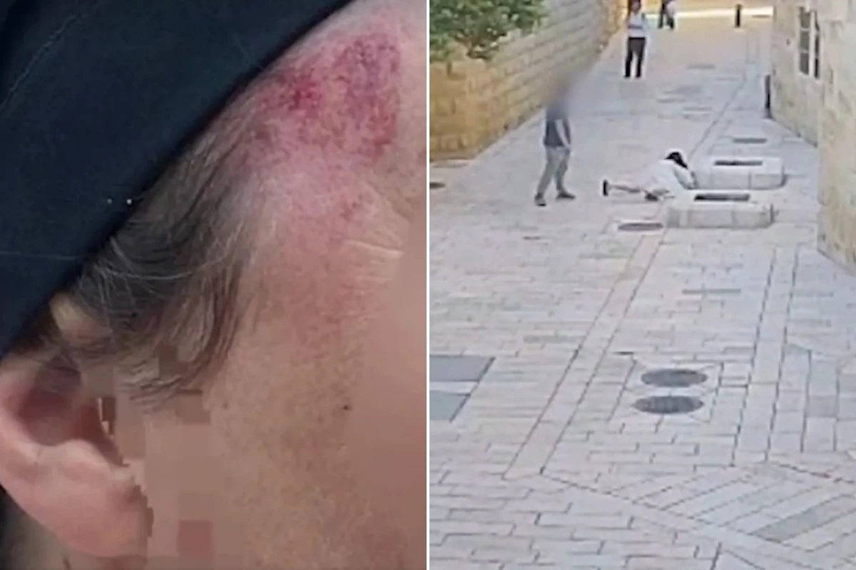 Uma freira foi agredida por um homem em Jerusalém, e o caso chocou moradores e internautas.